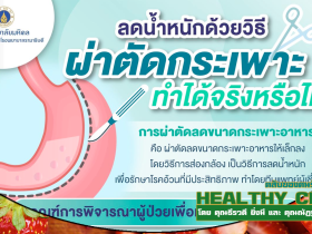 HealthClubลดน้ำหนักด้วยวิธีผ่าตัดกระเพาะ