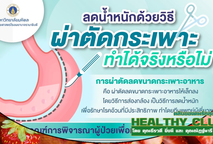 HealthClubลดน้ำหนักด้วยวิธีผ่าตัดกระเพาะ