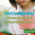 HealthClub TAVI ทางเลือกใหม่ นวัตกรรมซ่อมลิ้นหัวใจ
