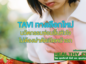 HealthClub TAVI ทางเลือกใหม่ นวัตกรรมซ่อมลิ้นหัวใจ