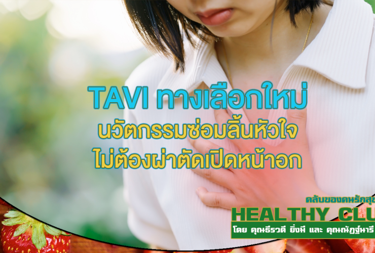HealthClub TAVI ทางเลือกใหม่ นวัตกรรมซ่อมลิ้นหัวใจ
