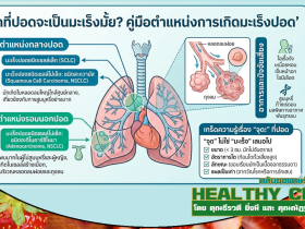 HealthClub เจอจุดที่ปอด ต้องกังวลแค่ไหน