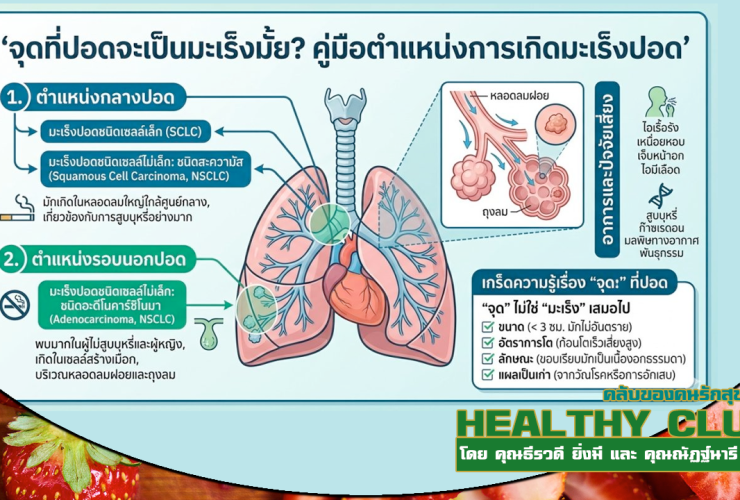 HealthClub เจอจุดที่ปอด ต้องกังวลแค่ไหน