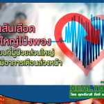 HealthClub โรคเส้นเลือดแดงใหญ่โป่งพอง