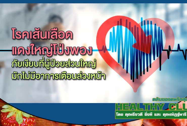 HealthClub โรคเส้นเลือดแดงใหญ่โป่งพอง
